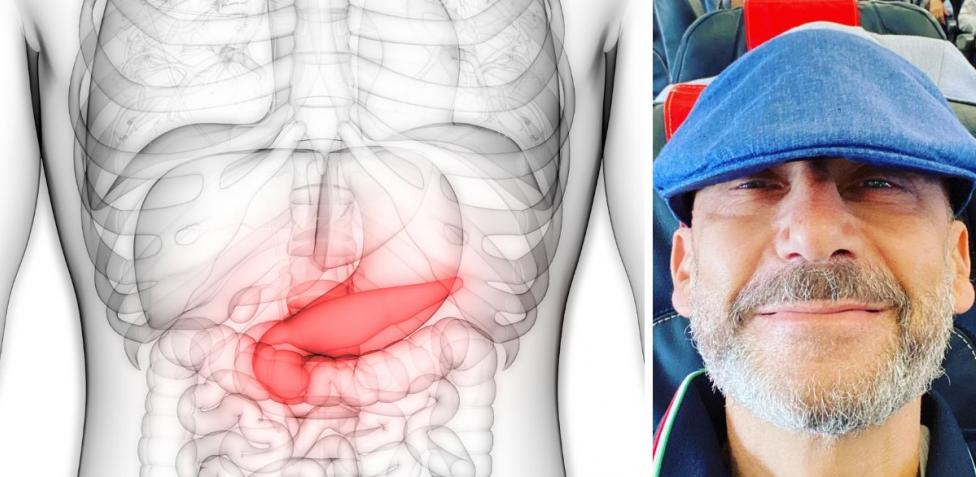 Gianluca Vialli morto per il tumore al pancreas. «È il cancro più letale»:  sintomi e cure