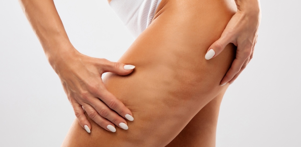 Integratori anticellulite: ecco quali sono i migliori rimedi naturali e davvero efficaci