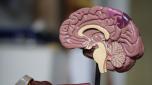 Demenza: la pressione alta può danneggiare alcune aree del cervello