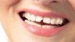 Woman smiles with broken tooth. Need a Dentist. Close up photo white background.