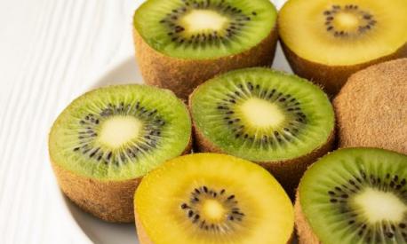 Kiwi gialli e verdi (Foto Getty)