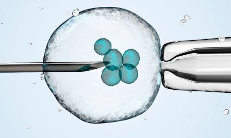 Crioconservazione ovociti per fecondazione in vitro