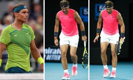 Rafael Nadal piede con sindrome di Mueller-Weiss