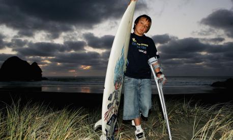 Elliot Paerata-Reid posa a Piha Beach dopo l'attacco subito a Raglan, in Nuova Zelanda nel dicembre 2006. Eliott aveva appena dieci anni. Ph. Phil Walter/Getty Images