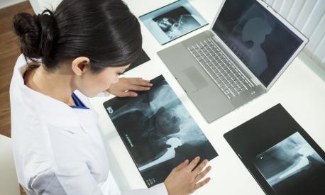 An Asian Chinese female medical doctor looking at x-rays of hip replacement and using laptop in a hospital