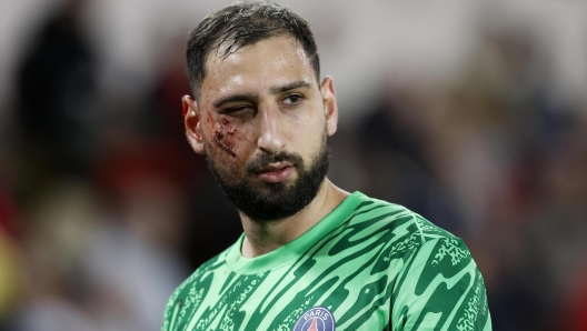 epaselect epa11784513 Goalkeeper Gianluigi Donnarumma of Paris Saint Germain leaves the pitch after receiving an injury during the French Ligue 1 soccer match AS Monaco vs Paris Saint Germain, at Stade Louis II, in Monaco, 18 December 2024.  EPA/SEBASTIEN NOGIER