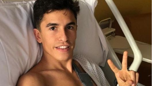 Marquez ha vissuto un 2020 da incubo, con tre operazioni all’omero destro fratturato (foto @marcmarquez93)