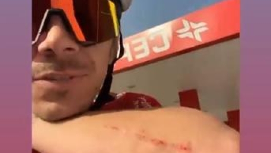 Le faccine che ridono postate da Marquez al racconto Instagram di Redding