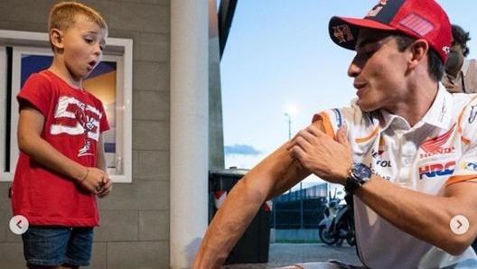 Marquez mostra la cicatrice sul braccio destro del piccolo fan