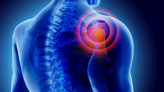 3D Illustration of shoulder painful, medical concept.