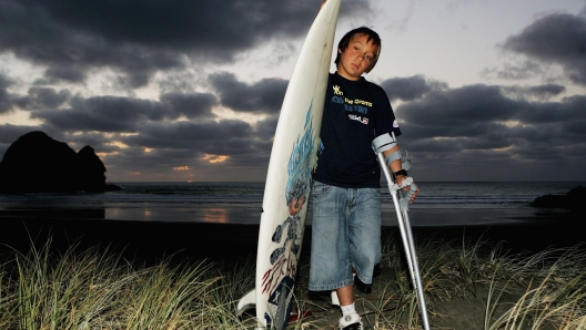 Elliot Paerata-Reid posa a Piha Beach dopo l'attacco subito a Raglan, in Nuova Zelanda nel dicembre 2006. Eliott aveva appena dieci anni. Ph. Phil Walter/Getty Images