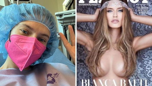 Bianca Balti operazione