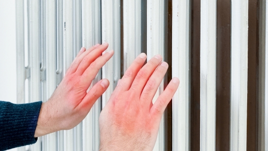 Chapped hands warming next to an home radiator