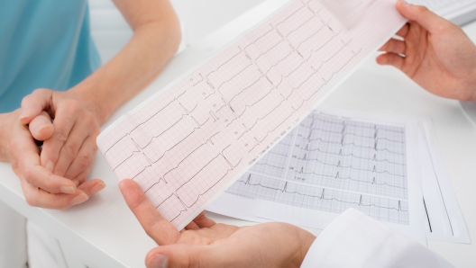 Doctor analyzes the electrocardiogram results, close-up. Diagnosis of arrhythmia, heart rate and heart disease