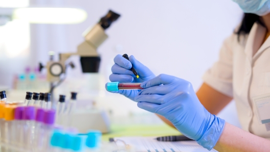 Woman working in a laboratory. He writes with a felt pen. Selective focus