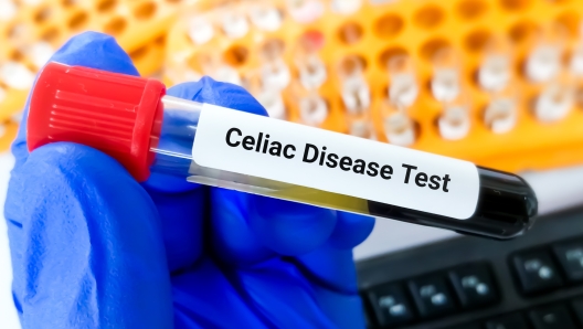 Blood sample tube for celiac disease test, help diagnose celiac disease and to evaluate the effectiveness of a gluten-free diet