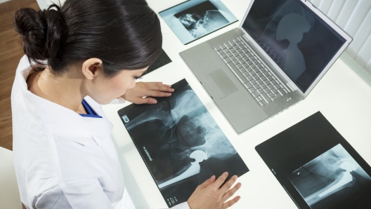 An Asian Chinese female medical doctor looking at x-rays of hip replacement and using laptop in a hospital