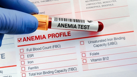 Blood sample for analysis of Anemia profile test in laboratory. doctor holding Blood tube test with requisition form for Anaemia test