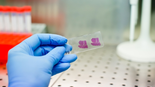 Close up photo of hand in blue glove handing histological liver tissue sample