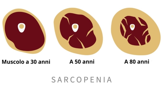 Sarcopenia effetto sui muscoli anziani