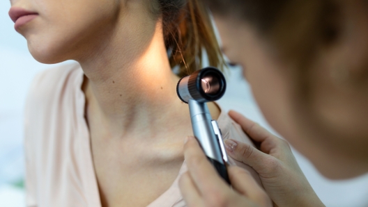 Doctor dermatologist examines skin of patient. Dermatoscopy, prevention of melanoma, skin cancer.