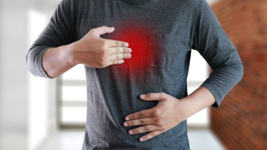 MAN with symptomatic acid reflux , suffering from acid reflux