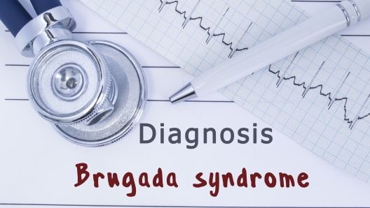 Diagnosis Brugada syndrome. Stethoscope or phonendoscope together with type of ECG lie on medical history with title diagnosis Brugada syndrome. Medical concept for cardiology and internal medicine