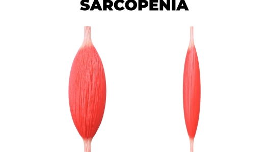 sarcopenia: cos'è