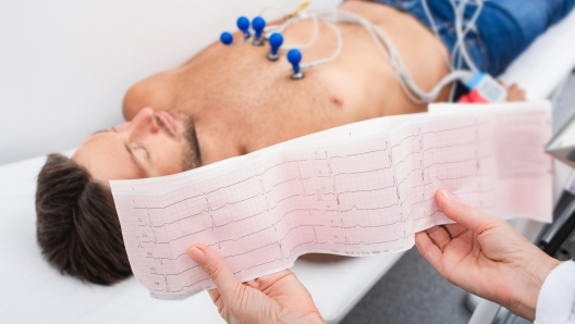 Doctor holding a cardiogram test, close-up of ECG report over a male patient. Diagnostic heart disease heart attack, tachycardia