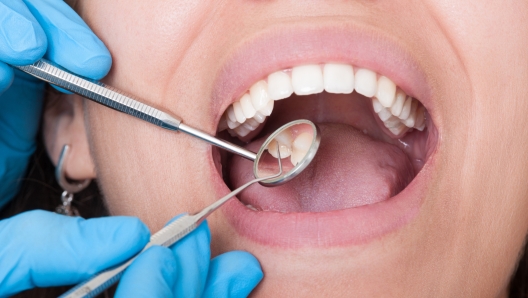 Closeup of dentist tools and mouth open with beautiful teeth