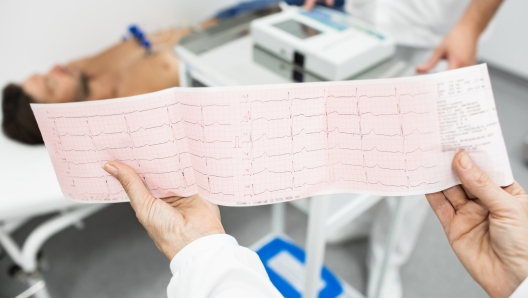 Cardiogram test, close-up of ECG report over mature male patient