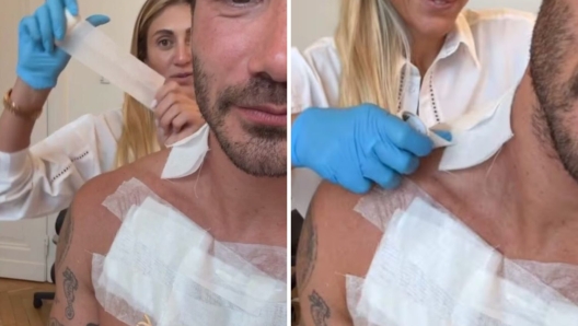 Stefano De Martino futuro su Rai 1 rimuove i tatuaggi