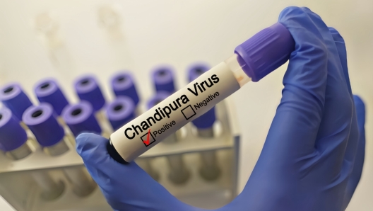 Virus Chandipura: come si trasmette e perché è così letale