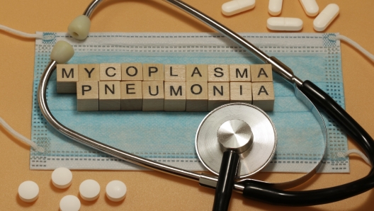 Polmonite da mycoplasma pneumoniae: cos'è, i sintomi e perché i casi sono in aumento