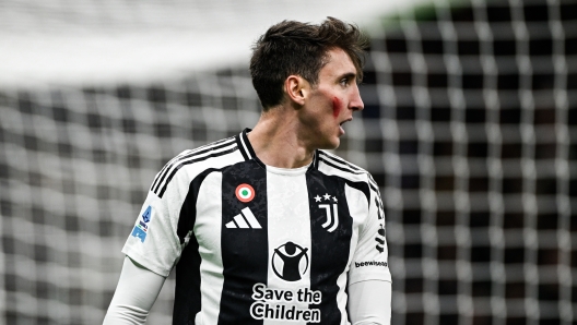 MILAN, ITALY - NOVEMBER 23: Andrea Cambiaso of Juventus during the Serie A match between AC Milan and Juventus at Stadio Giuseppe Meazza on November 23, 2024 in Milan, Italy. (Photo by Daniele Badolato - Juventus FC/Juventus FC via Getty Images)