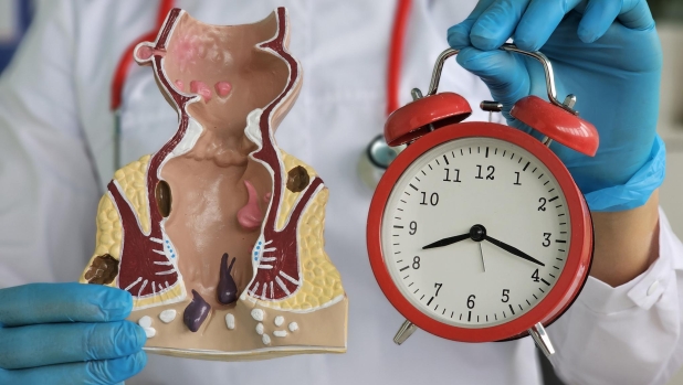 Tumore al colon-retto: bastano pochi minuti di sport al giorno per proteggersi dal cancro