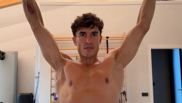 Marc Marquez e la foto shock della spalla dopo 7 operazioni. Ma come fa a gareggiare?