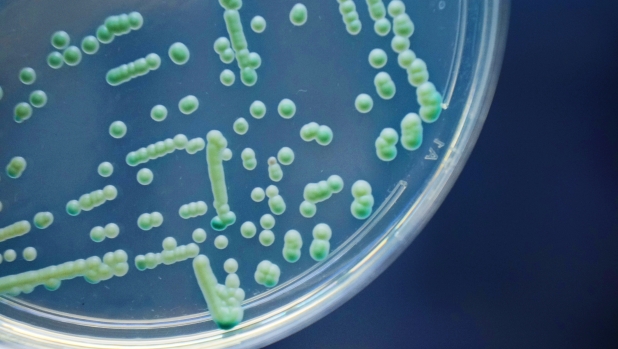 Cura della candida: la svolta in uno studio sull'infezione fungina potenzialmente mortale