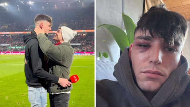Aggredito l'arbitro Kaiser: aveva fatto la proposta di matrimonio al compagno prima di Colonia-Wolfsburg
