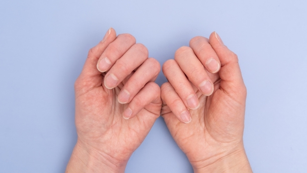 Melanoma ungueale: cos'è e come scovarlo