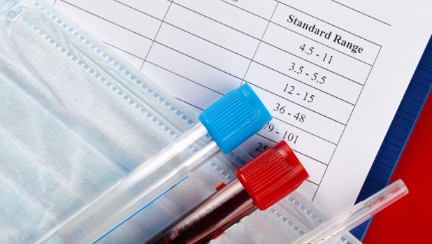 Un puntura del dito per fare le analisi del sangue a casa: è possibile grazie all'AI