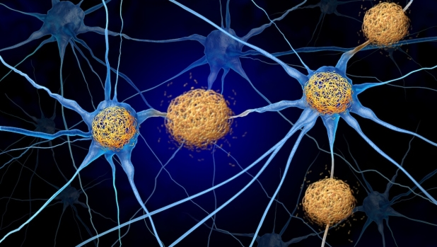Meno proteine per vivere più a lungo? Lo dice la scienza