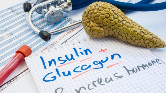 Pancreas gland hormones insulin and glucagon concept photo. Notepad inscribed with insulin and glucagon is near figures of pancreas, lab test tube with blood and stethoscope