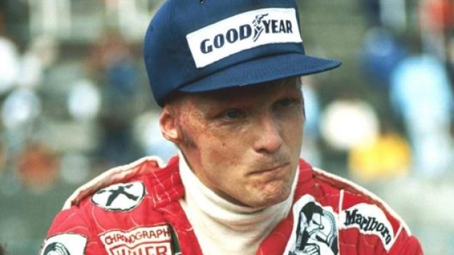 Il volto di Niki Lauda segnato dopo l’incidente al Nurburgring nel 1976