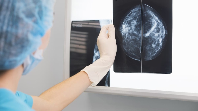 mammografia con tomosintesi