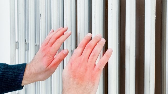 Chapped hands warming next to an home radiator
