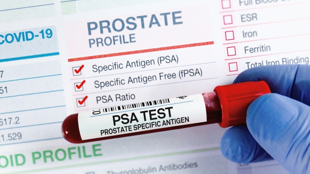 Blood tube test with requisition form for PSA Prostate Specific Antigen test. Blood sample for analysis of PSA Prostate Specific Antigen profile test in laboratory