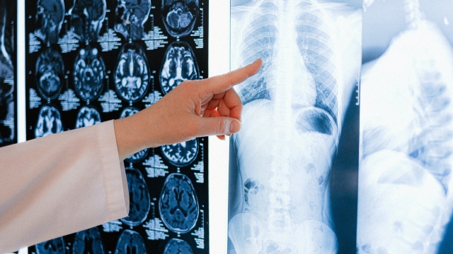 Radiografia e tac ai polmoni