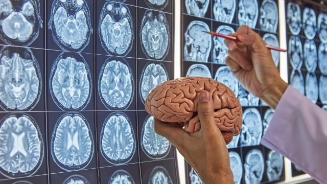 A neurosurgeon holding human brain model and pointing at brain MRI on lightbox in medical office