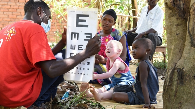 Before intervention: Simon Mugerwa takes Aisha through a snellen chart during his home visit in Eastern Uganda. Aisha (4 years) is a child with low vision and strong challenges in daily life due to albinism. Even her brother Akram (2,5 years) is facing the same condition and challenges. Both are clients of CBM partner Mengo Hospital. Please refer to the related story for more information.